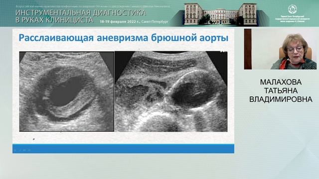 Ультразвуковое исследование в ургентных ситуациях у постели больного: на что нужно обратить внимани смотреть онлайн