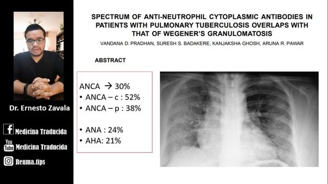 ?ANTICUERPOS ANTINUCLEARES: ¿Qué significa ANA+?⛔ [Lupus, Esclerodermia, Artritis Reumatoide] смотреть онлайн