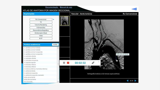 Radiologia: Estude pelo programa Atlas de Anatomia смотреть онлайн