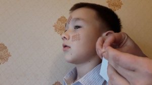 Логопедия. Тейпирование подъязычного нерва. Преподаватель Зайцевой Е.С.