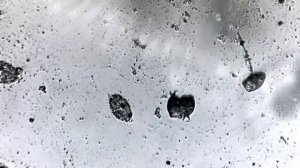 микробы под микроскопом, редкое зрелище!