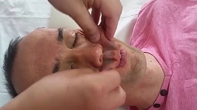 Академия Цань Тун Ци . Пластика лица (часть 7)