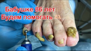 Бабушке 86 лет - будем помогать