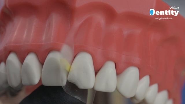 Class IV Composite Practice | حشوات الأسنان الأمامية عملي смотреть онлайн