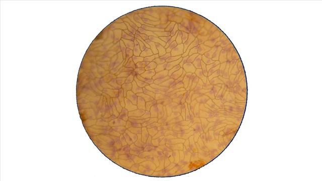 Эпителиальные ткани-2: Мезотелий