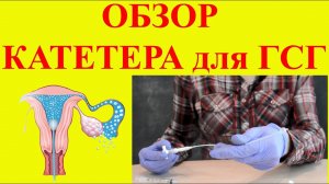 Обзор катетера для ГСГ (гистеросальпингографии)