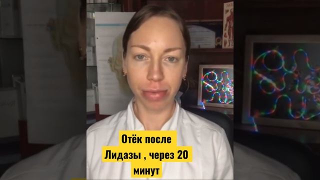 Лидаза !Отёк после раскола старого геля в губах смотреть онлайн