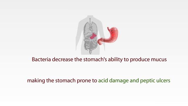 Everything You Need To Know:Helicobacter Pylori Testing(H.pylori) смотреть онлайн