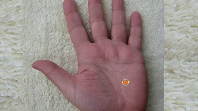 СуДжок. Сахарный диабет смотреть онлайн