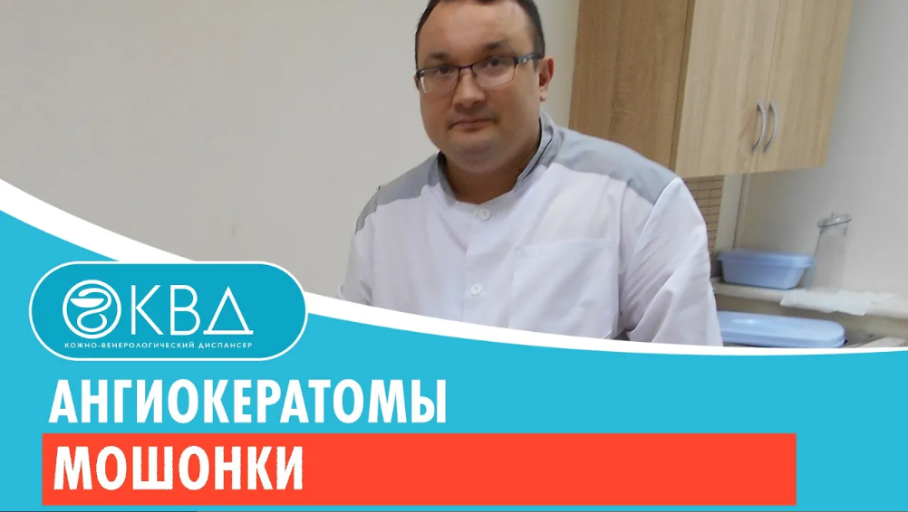 ?♂️ Ангиокератомы мошонки Клинический случай №428 смотреть онлайн