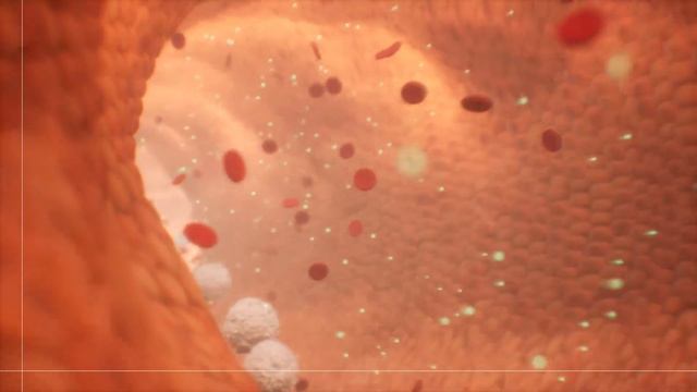 Ulcerative Colitis Medications | 3D Medical Animation | Pixeldust Studios смотреть онлайн