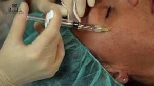 13. Процедура для кожи Meso Wharton P199 в RTH