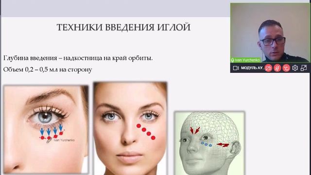 Периорбитальная область. Вебинар смотреть онлайн