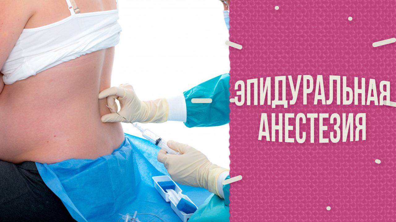 Что-то стало отпускать! (Эпидуральная анестезия) смотреть онлайн