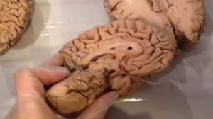 Анатомия человека. Мозг.