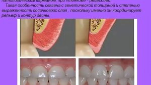 Пародонт  Строение и функции  Классификация заболеваний пародонта  Клиника, диагностика