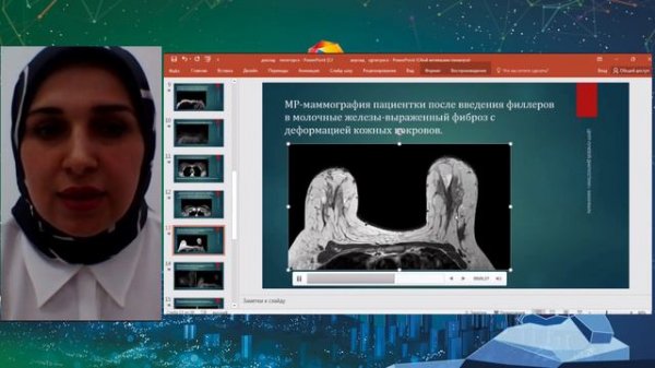 10  Лучевая диагностика постинъекционных осложнений   Караева Айшат Караевна