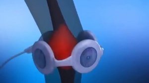 Аппарат Алмаг-01