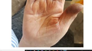 Рука долгожителя. Линии на руке в 93 года рука хиромантия возраст линия брака