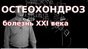 ? ОСТЕОХОНДРОЗ позвоночника (симптомы, причины и лечение)