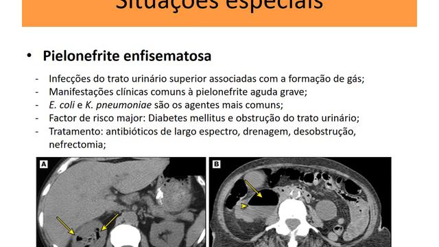 12 Infecção Urinaria смотреть онлайн