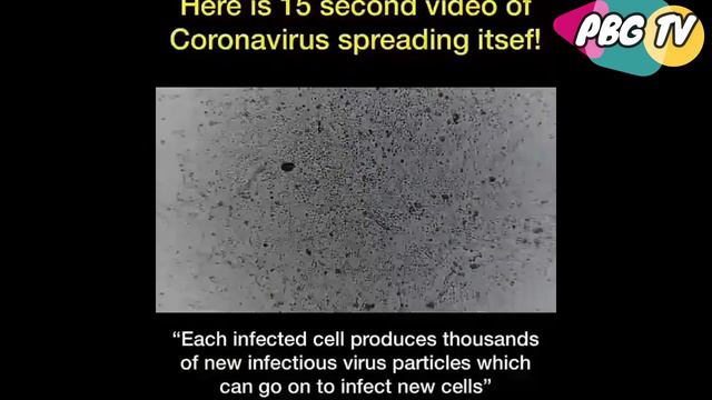 Penampakan Virus Jika Dilihat Dari Mikroskop