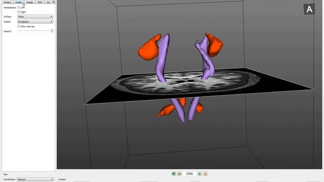 Braviz смотреть онлайн