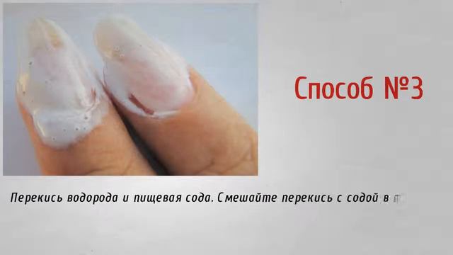 Как отбелить ногти в домашних условиях смотреть онлайн