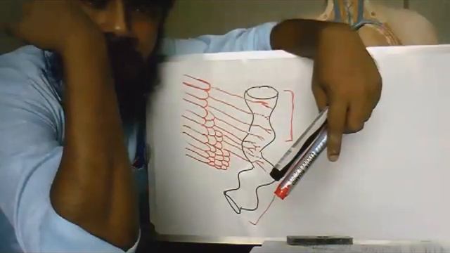 Story of Gross Anatomy II Jejunum & Ileum II Why coiled II Villi II Peyer's patches II Differences смотреть онлайн