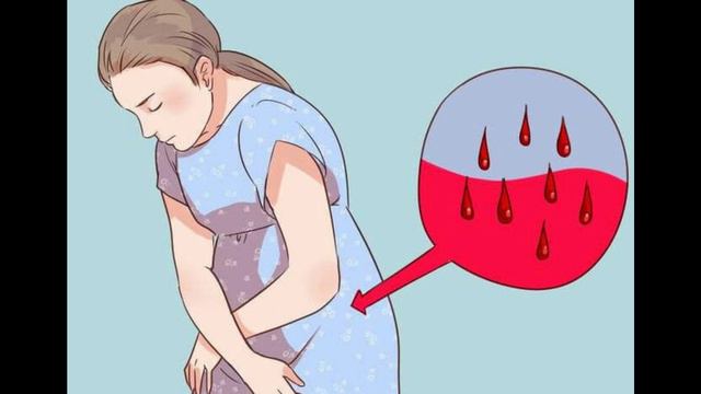 HOMILADORLIKDA QON KETISHI – SABABLARI, BELGILARI, TASHXISLASH VA DAVOLASH USULLARI смотреть онлайн