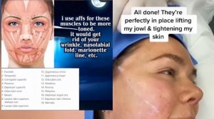 ༄༊ FACE LIFTING & Youthful Skin Subliminal +  hifu, thread lift, filler {RESULT IN 1 LISTEN}