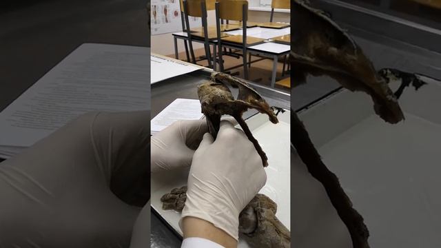 Плечевой сустав. Суставы. Анатомия смотреть онлайн