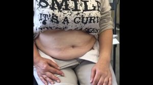 Как работать с животом после удаления желчного пузыря.