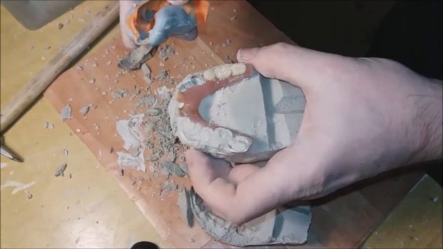 Ремонт зубного съемного протеза. Приварка зуба.