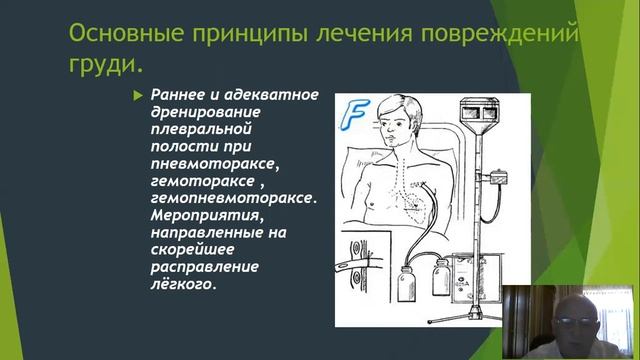 ТРАВМА ГРУДИ 1 смотреть онлайн
