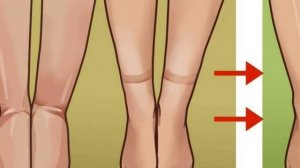 ?КАК БЫСТРО СНЯТЬ ОТЁЧНОСТЬ НОГ! ЛЕЧИМ ОТЕК НОГ ДОМА!