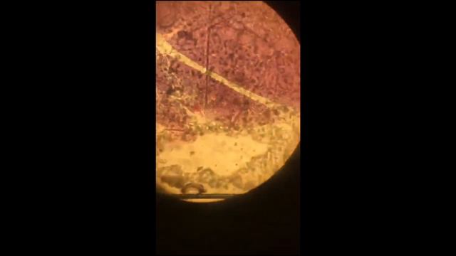 PATHOLOGY 2 || Microscope slides || 2 смотреть онлайн