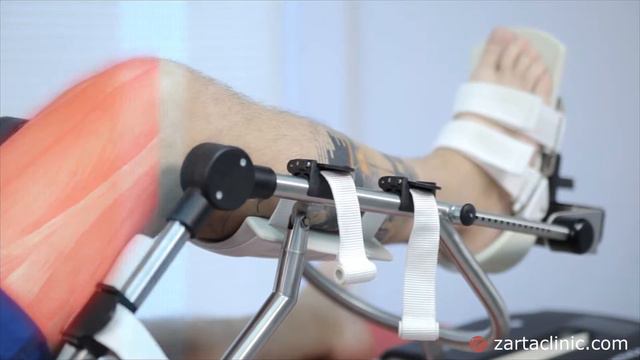 Механотерапия Zarta смотреть онлайн