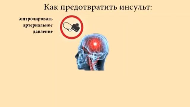 Инсульт смотреть онлайн