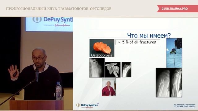 Лечение сложных случаев переломов проксимального отдела плечевой кости смотреть онлайн