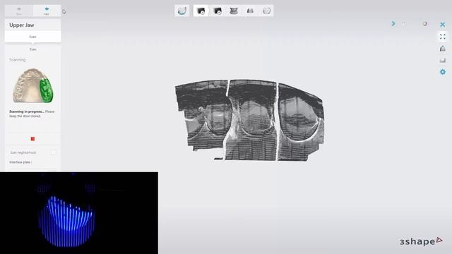 3Shape D2000 - 3D сканер | 3Shape (Дания) смотреть онлайн