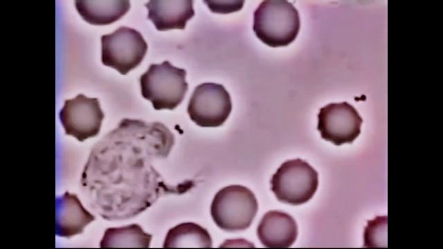 Neutrophil chasing Staphylococcus aureus - Immunology смотреть онлайн