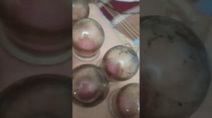 ставим  банки