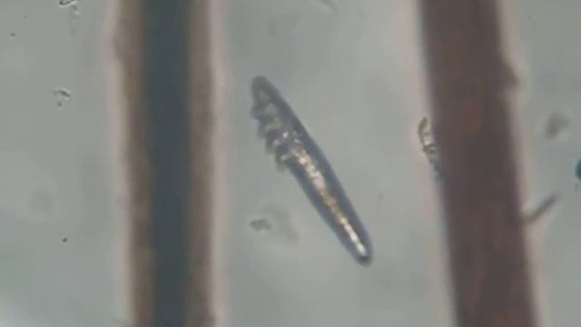 Клещ Demodex canis.avi смотреть онлайн