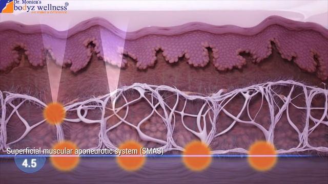 HIFU Treatment (High Intensity Focused Ultrasound) смотреть онлайн