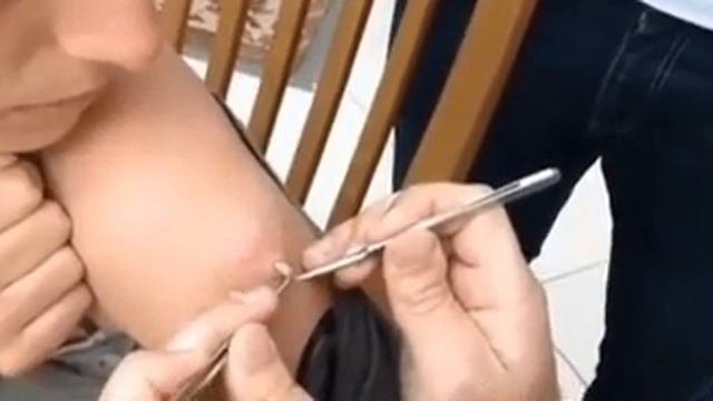 почувствуешь укус-укол от мухи - бойся смотреть онлайн
