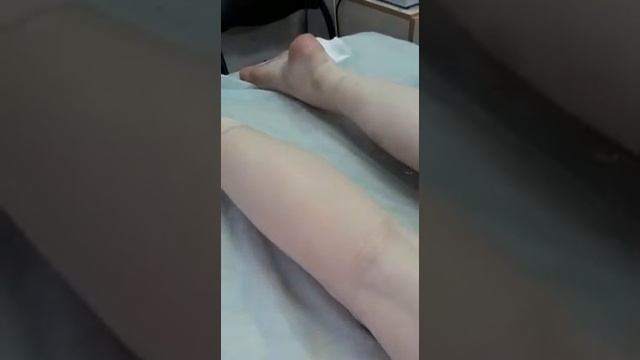 Бандажная техника. Воск