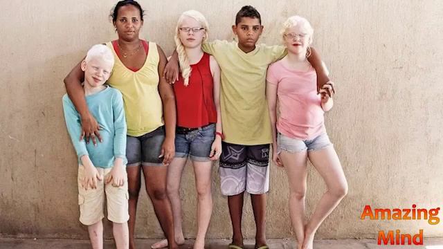 Альбиносы - РЕДКИЕ ЛЮДИ смотреть онлайн