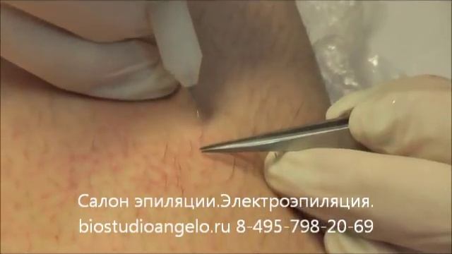 Эпиляция часть 1.wmv