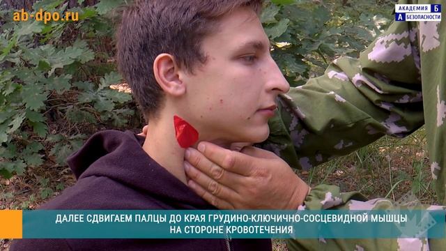 Остановка кровотечения из сонной артерии прижатием. Способ №1 смотреть онлайн